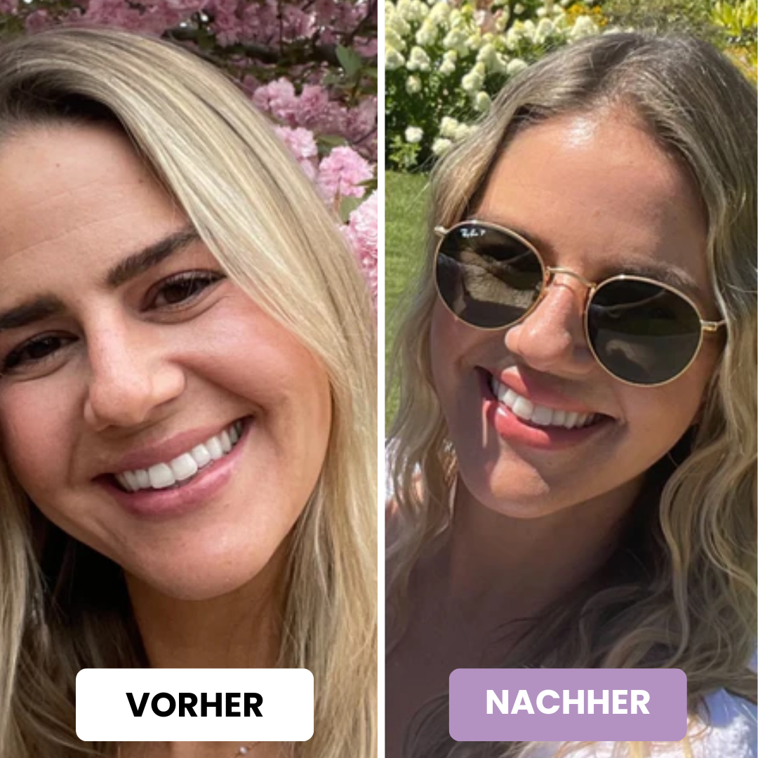 ScarAway™ | Silikon-Narbenpflaster - ShopVectura