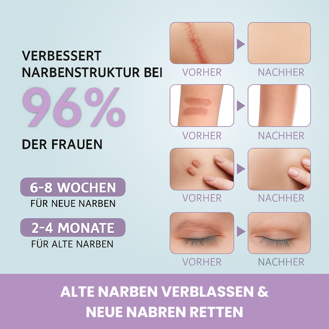 ScarAway™ | Silikon-Narbenpflaster - ShopVectura